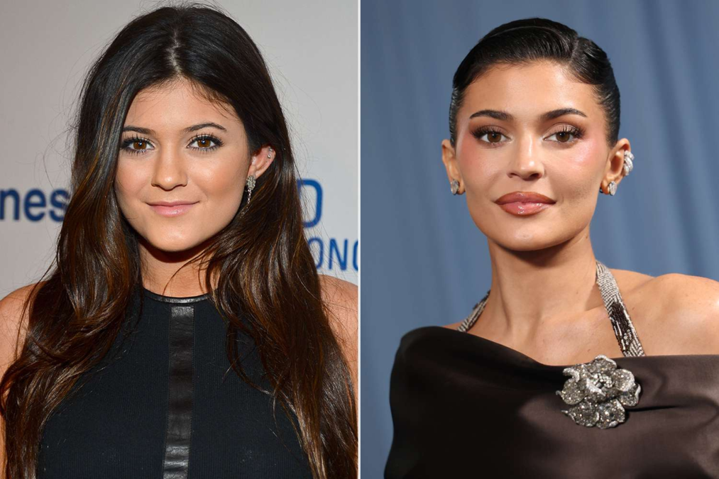 kylie jenner before and after kylie jenner before and after