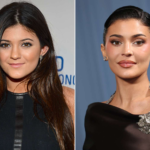 kylie jenner before and after