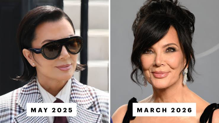 kris jenner is reportedly unhappy with her sagging facelift